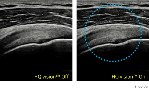 Ultrassonografia musculoesquelética